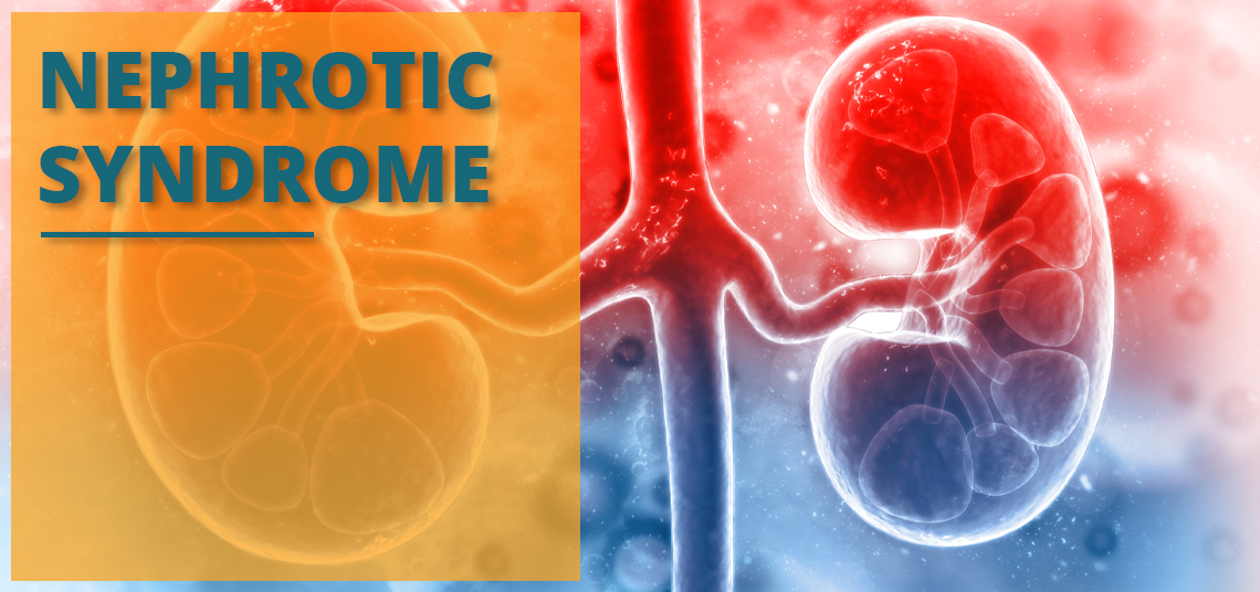 nephrotic syndrome kidney
